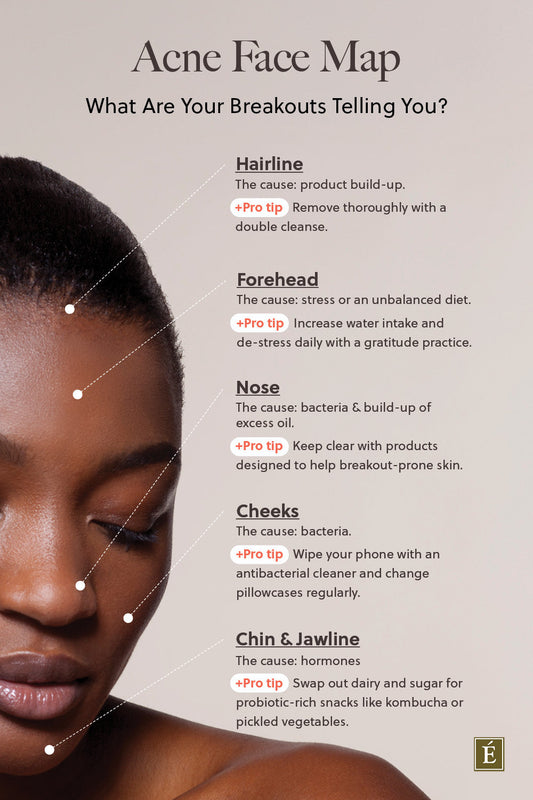 What Your Breakouts Might Be Telling You