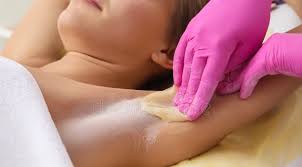 Sugaring: Underarms